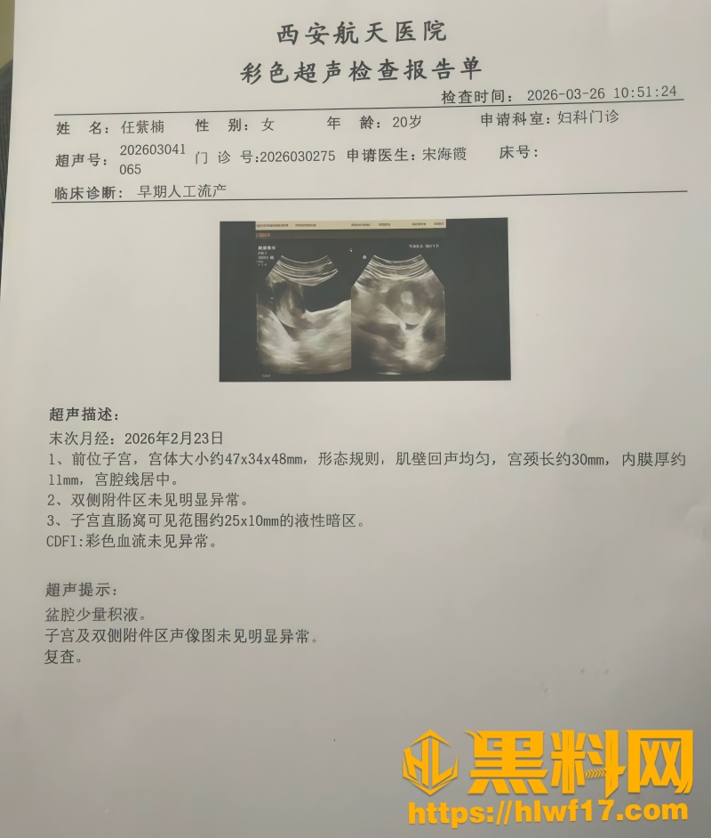 安康职院任紫楠早期人流 3