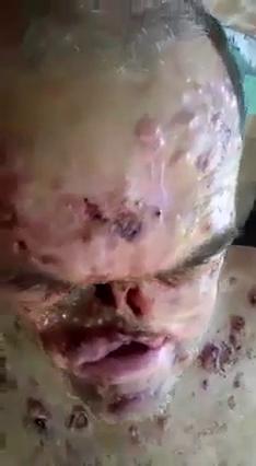 寄生虫快要把他吃光了 포스터