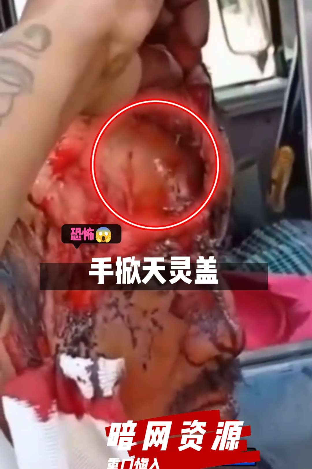 Плакат для 〔暗网资源〕偷掀天灵盖，恐怖?