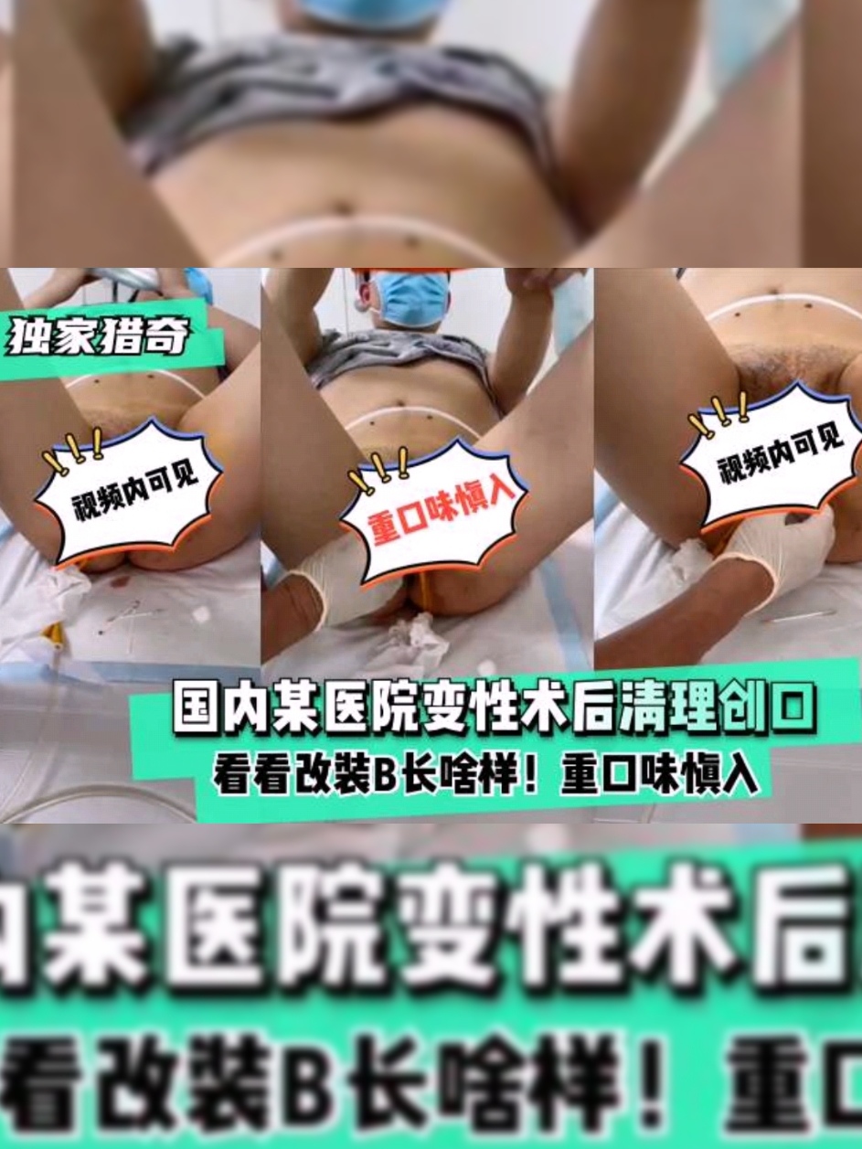 Áp phích cho 【独家猎奇】国内某医院变性术后清理创口