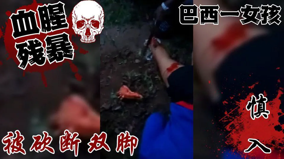 โปสเตอร์สำหรับ 巴西女孩遭歹徒砍断脚并被刺伤