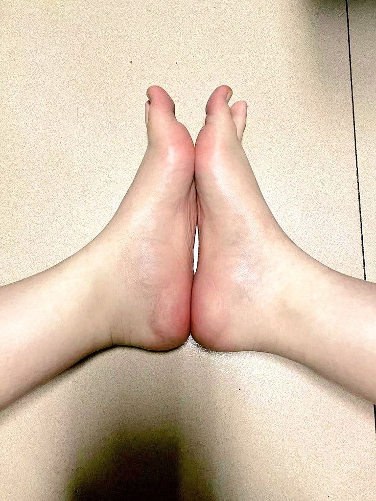 在想下次早上露出我就是傻逼，冷死了，我真是疯了！！